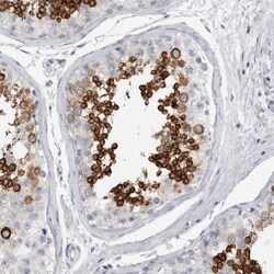 Invitrogen ADAM2 Polyclonal Antibody 100 &mu;L | Buy Online | Invitrogen&trade; | Fisher Scientific