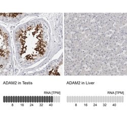 Invitrogen ADAM2 Polyclonal Antibody 100 &mu;L | Buy Online | Invitrogen&trade; | Fisher Scientific