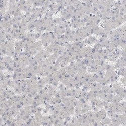 Invitrogen ADAM2 Polyclonal Antibody 100 &mu;L | Buy Online | Invitrogen&trade; | Fisher Scientific