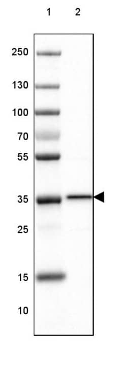 Invitrogen RABGGTB Polyclonal Antibody 100 &mu;L; Unconjugated:Antibodies,