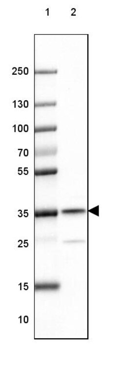 Invitrogen RABGGTB Polyclonal Antibody 100 &mu;L; Unconjugated:Antibodies,