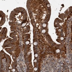 Invitrogen RABGGTB Polyclonal Antibody 100 &mu;L; Unconjugated:Antibodies,