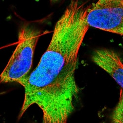 Invitrogen VWDE Polyclonal Antibody 100 &mu;L; Unconjugated:Antibodies,