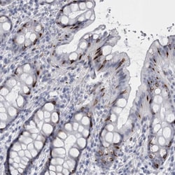 Invitrogen VWDE Polyclonal Antibody 100 &mu;L; Unconjugated:Antibodies,