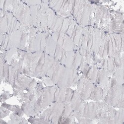 Invitrogen IFI30 Polyclonal Antibody 100 &mu;L | Buy Online | Invitrogen&trade; | Fisher Scientific