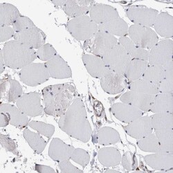 Invitrogen CCDC88B Polyclonal Antibody 100 &mu;L | Buy Online | Invitrogen&trade; | Fisher Scientific