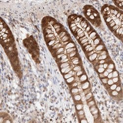 Invitrogen STARD10 Polyclonal Antibody 100 &mu;L; Unconjugated:Antibodies,