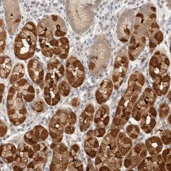 Invitrogen STARD10 Polyclonal Antibody 100 &mu;L; Unconjugated:Antibodies,