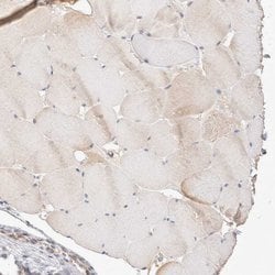 Invitrogen STARD10 Polyclonal Antibody 100 &mu;L; Unconjugated:Antibodies,