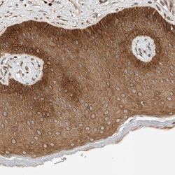 Invitrogen ARMC9 Polyclonal Antibody 100 &mu;L; Unconjugated:Antibodies,