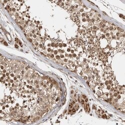 Invitrogen CCDC132 Polyclonal Antibody 100 &mu;L; Unconjugated:Antibodies,