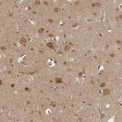 Invitrogen CCDC132 Polyclonal Antibody 100 &mu;L; Unconjugated:Antibodies,