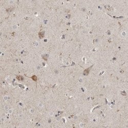Invitrogen MUPP1 Polyclonal Antibody 100 &mu;L; Unconjugated:Antibodies,