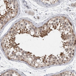 Invitrogen AASDHPPT Polyclonal Antibody 100 &mu;L; Unconjugated:Antibodies,