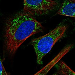 Invitrogen IMMP2L Polyclonal Antibody 100 &mu;L; Unconjugated:Antibodies,