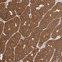 Invitrogen IMMP2L Polyclonal Antibody 100 &mu;L; Unconjugated:Antibodies,