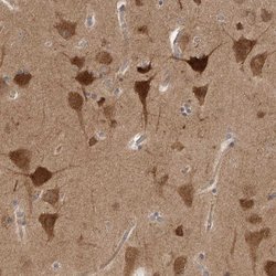 Invitrogen PRKAR1B Polyclonal Antibody 100 &mu;L; Unconjugated:Antibodies,