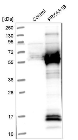 Invitrogen PRKAR1B Polyclonal Antibody 100 &mu;L; Unconjugated:Antibodies,