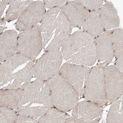 Invitrogen DHDDS Polyclonal Antibody 100 &mu;L; Unconjugated:Antibodies,