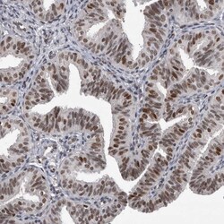 Invitrogen POLD2 Polyclonal Antibody 100 &mu;L; Unconjugated:Antibodies,