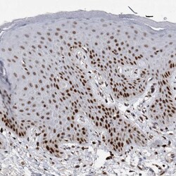Invitrogen POLD2 Polyclonal Antibody 100 &mu;L; Unconjugated:Antibodies,