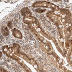 Invitrogen C9orf41 Polyclonal Antibody 100 &mu;L; Unconjugated:Antibodies,