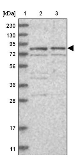 Invitrogen POLH Polyclonal Antibody 100 &mu;L | Buy Online | Invitrogen&trade; | Fisher Scientific