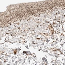 POLH Polyclonal Antibody:Antibodies, Polyclonal