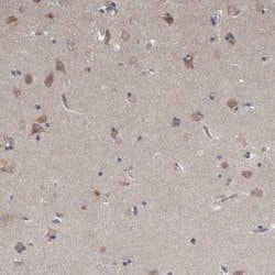 Invitrogen NENF Polyclonal Antibody 100 &mu;L; Unconjugated:Antibodies,
