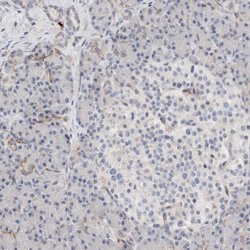 ECHDC2 Polyclonal Antibody:Antibodies, Polyclonal