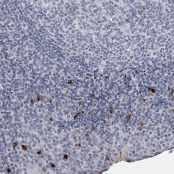 Invitrogen SLC25A39 Polyclonal Antibody 100 &mu;L; Unconjugated:Antibodies,