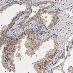 Invitrogen HUS1 Polyclonal Antibody 100 &mu;L; Unconjugated:Antibodies,