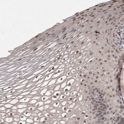 Invitrogen HUS1 Polyclonal Antibody 100 &mu;L; Unconjugated:Antibodies,