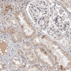 Invitrogen RNF213 Polyclonal Antibody 100 &mu;L; Unconjugated:Antibodies,