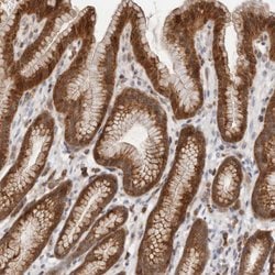 Invitrogen RNF213 Polyclonal Antibody 100 &mu;L; Unconjugated:Antibodies,