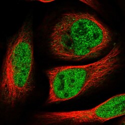 Hoxc5 Polyclonal Antibody:Antibodies, Polyclonal