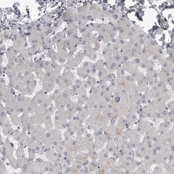 Invitrogen PRRX2 Polyclonal Antibody 100 μL; Unconjugated:Antibodies,