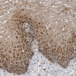 Invitrogen PRRX2 Polyclonal Antibody 100 μL; Unconjugated:Antibodies,