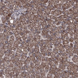 Invitrogen PCDH17 Polyclonal Antibody 100 &mu;L; Unconjugated:Antibodies,