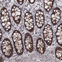 Invitrogen PCDH17 Polyclonal Antibody 100 &mu;L; Unconjugated:Antibodies,