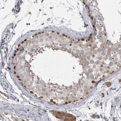 Invitrogen PHF13 Polyclonal Antibody 100 &mu;L; Unconjugated:Antibodies,