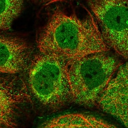 Invitrogen C1orf21 Polyclonal Antibody 100 &mu;L; Unconjugated:Antibodies,