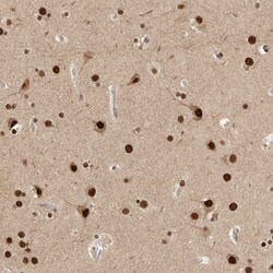 Invitrogen C1orf21 Polyclonal Antibody 100 &mu;L; Unconjugated:Antibodies,