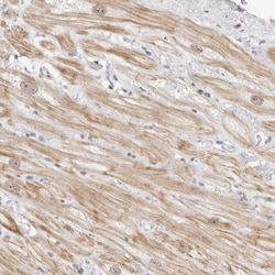 Invitrogen LARP7 Polyclonal Antibody 100 &mu;L; Unconjugated:Antibodies,