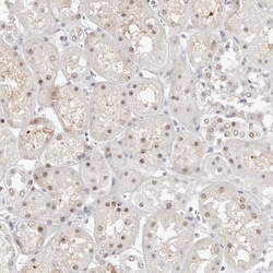 Invitrogen LARP7 Polyclonal Antibody 100 &mu;L; Unconjugated:Antibodies,
