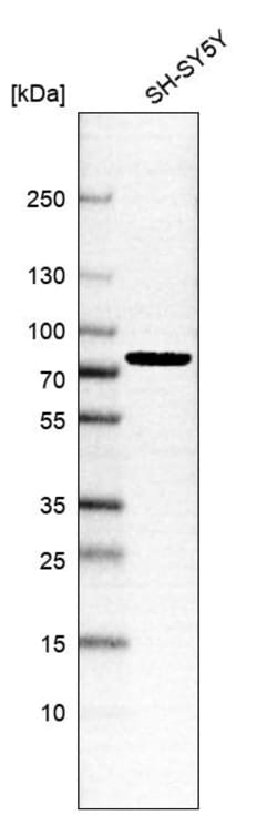 Invitrogen LARP7 Polyclonal Antibody 100 &mu;L; Unconjugated:Antibodies,