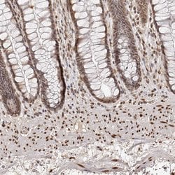 Invitrogen ZNF503 Polyclonal Antibody 100 &mu;L; Unconjugated:Antibodies,
