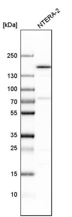 Invitrogen SMARCC1 Polyclonal Antibody 100 &mu;L | Buy Online | Invitrogen&trade; | Fisher Scientific