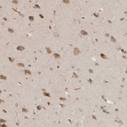 Invitrogen CCPG1 Polyclonal Antibody 100 &mu;L; Unconjugated:Antibodies,