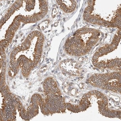 Invitrogen CCPG1 Polyclonal Antibody 100 &mu;L; Unconjugated:Antibodies,